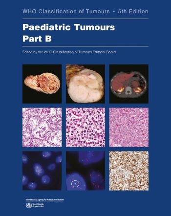WHO Classification of Paediatric Tumours, 5th edition - Part A WHO Classification of Paediatric Tumours, 5th edition - Part A