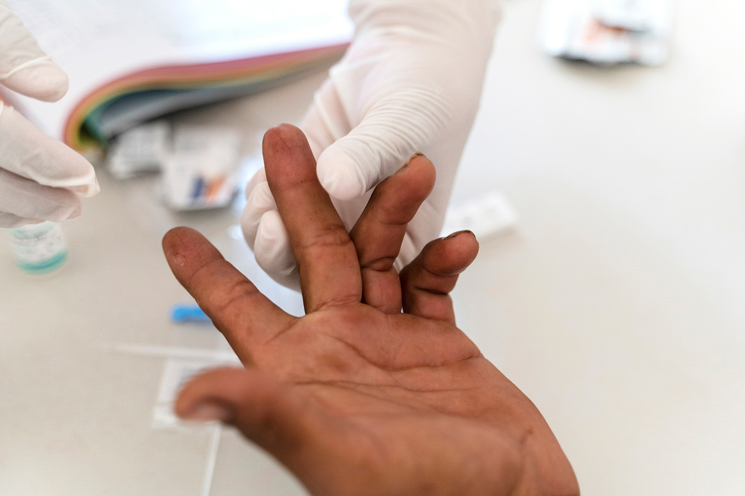 Health worker prepares to perform a malaria rapid diagnostic test for a patient.