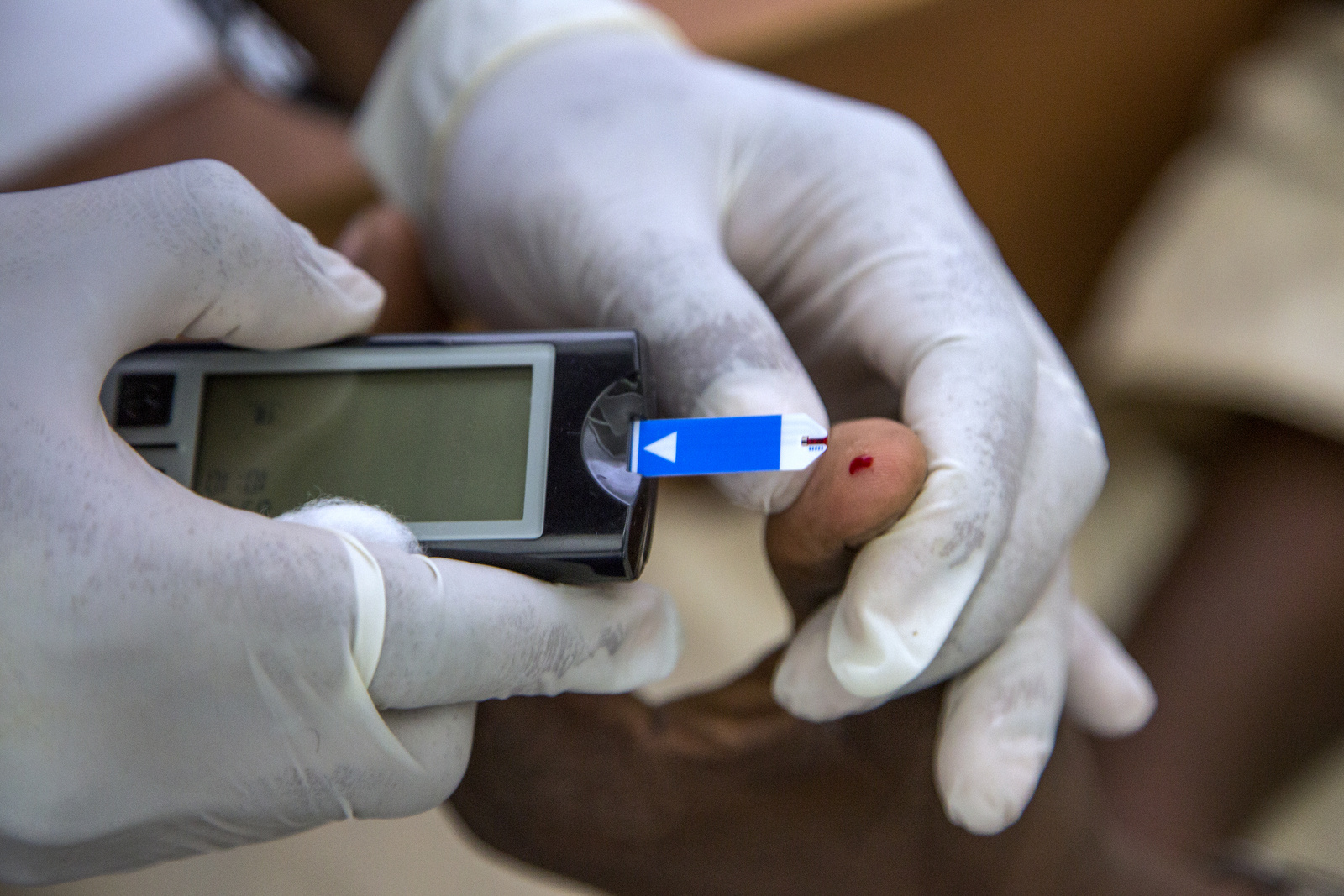 Health professional uses a lancet to prick the finger of patient