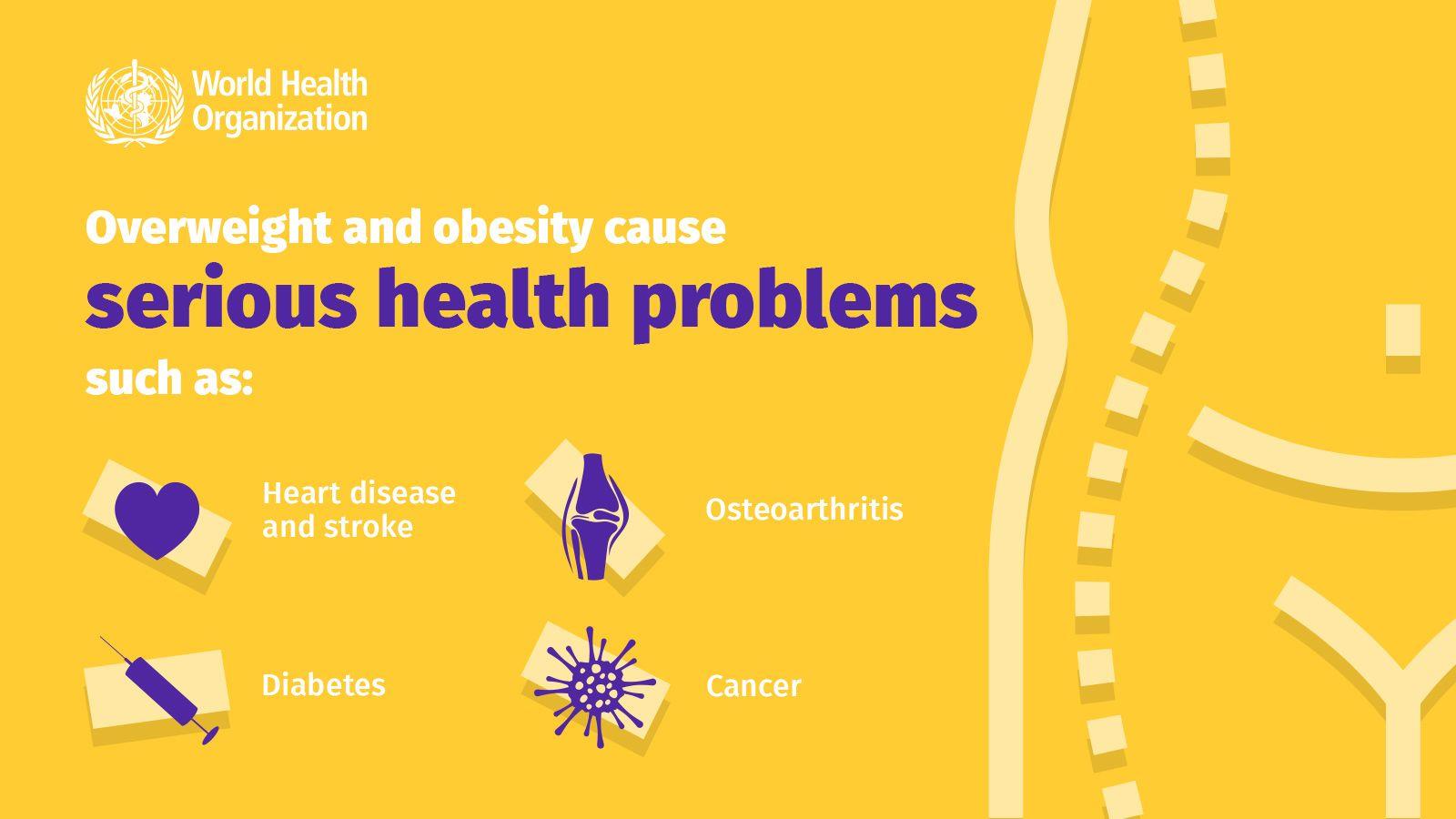 Obesity2 Obesity2