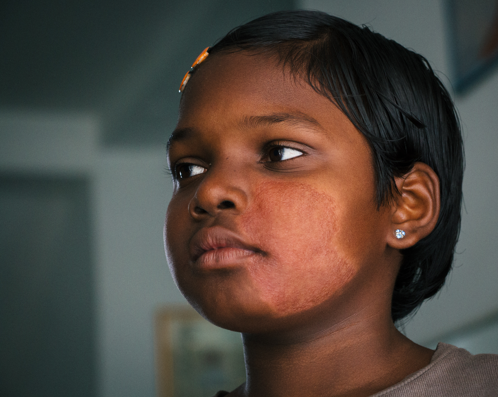 Eliminate leprosy-related discrimination, prejudice and stigma to