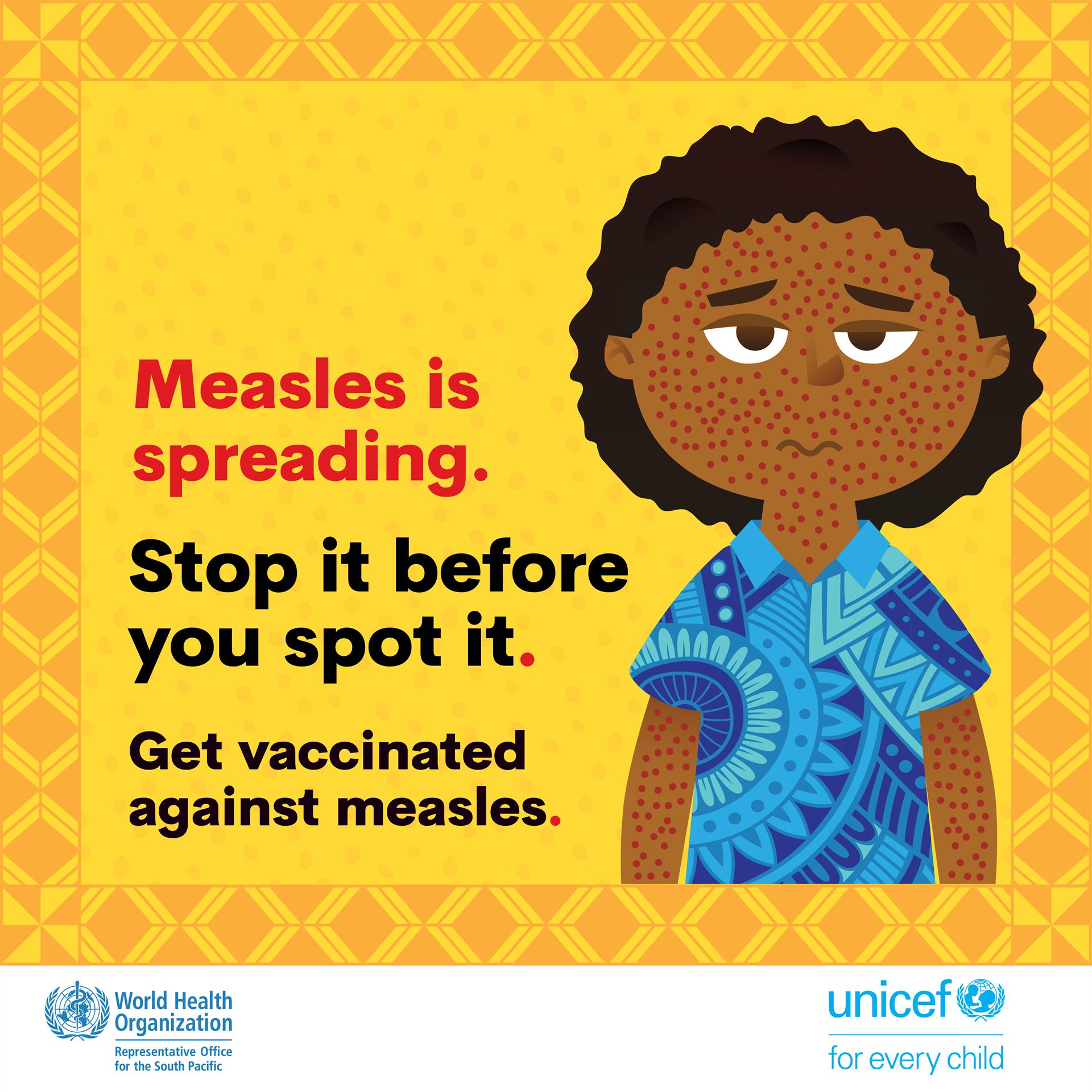 Measles is spreading
