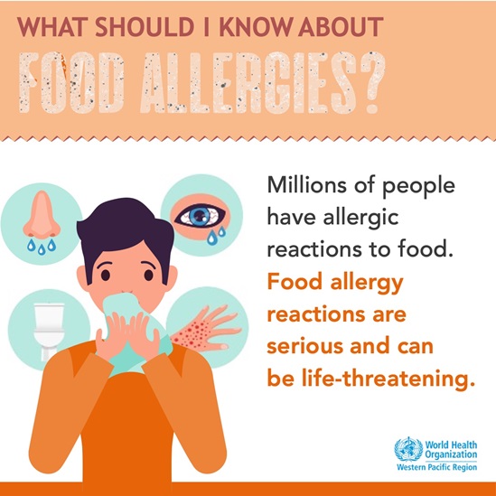 What you should know about food allergies